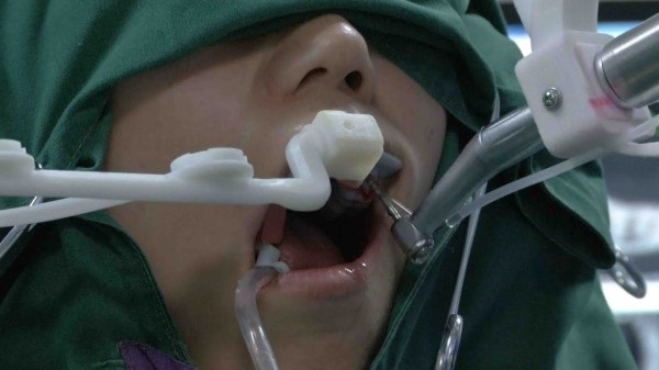 В Китае робот-стоматолог провел успешную операцию по установке имплантов человеку